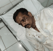 Leaked Image Sparks Intense Speculation Over Identity of Slain CJNG Leader "El Mencho" 1 img 6544 1